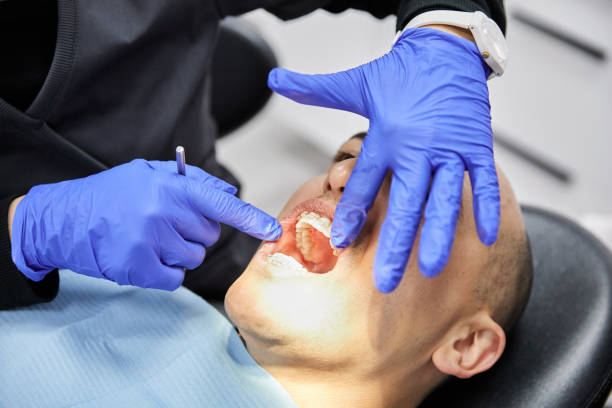 Best Chipped Tooth Repair Near Me  in Dayton, WA